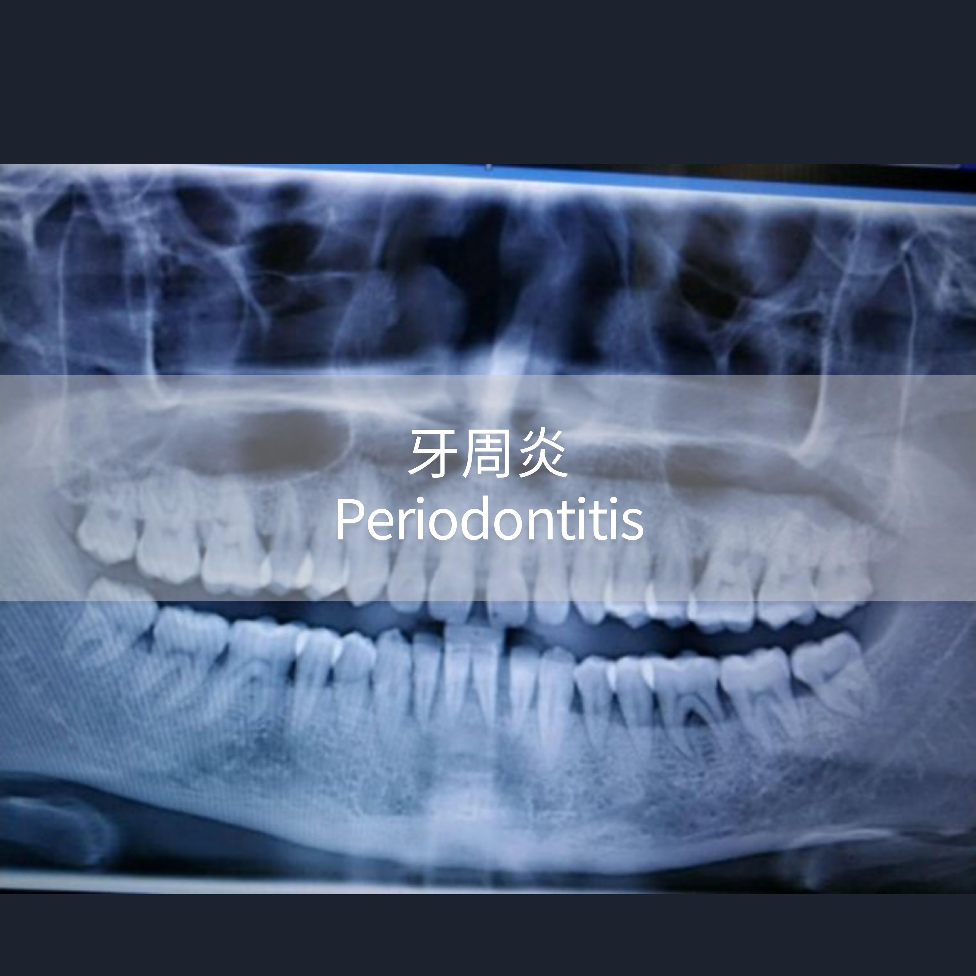 适应症的PPT_04
