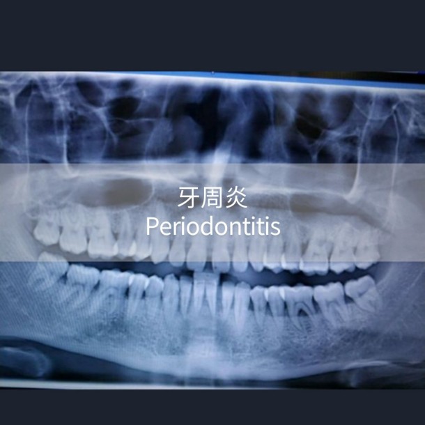 适应症的PPT_04
